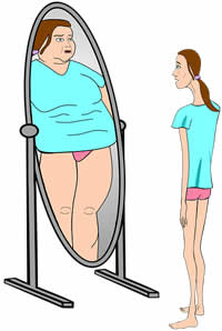 anorexia